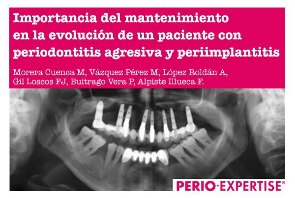 Mantenimiento periodontitis agresiva y periimplantitis