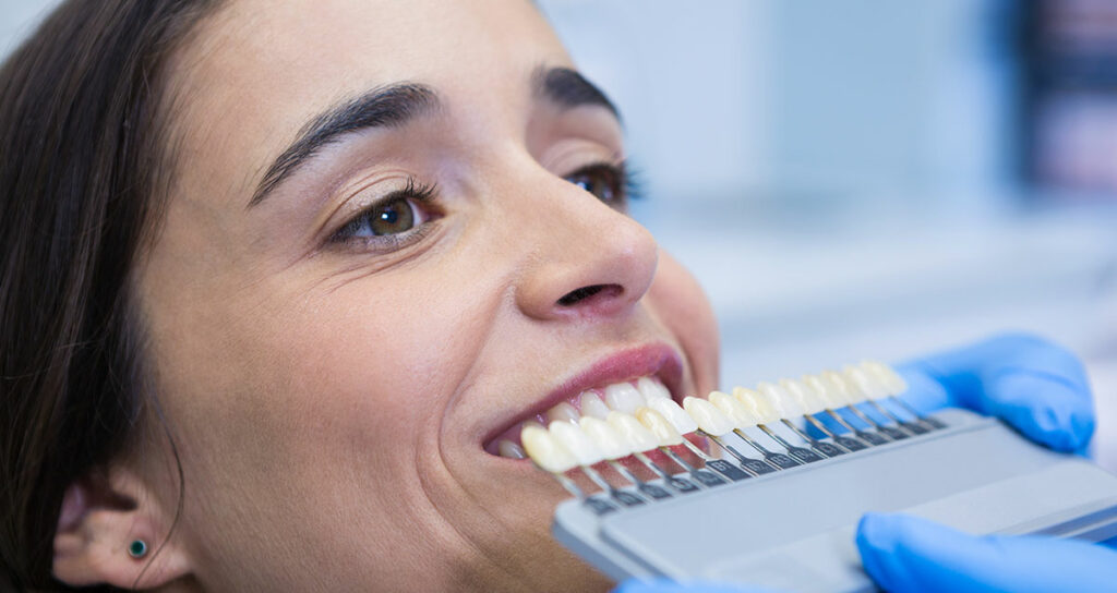 Blanqueamiento dental